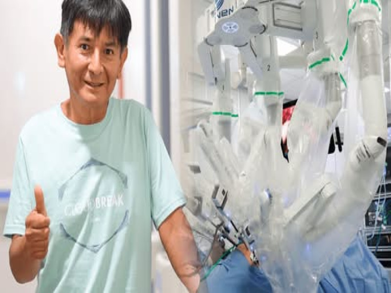 Robot opera a peruano con cáncer de estómago y le salva la vida.